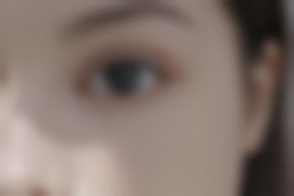 疤痕修复技术细腻可靠