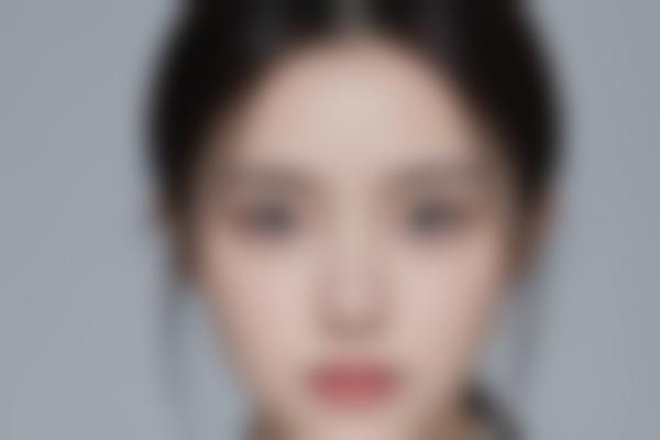 张勇