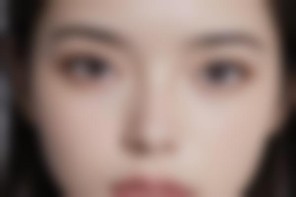 4、孙大山吸脂术后指导细致