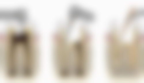 李珊珊医生真实实例：见证治疗成效