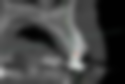 江苏苏州占昌文口腔价格表：性价比极高的口腔选择