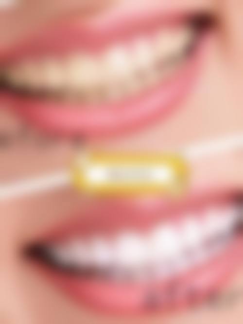 净月青尚口腔门诊部价格表：性价比极高