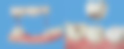 长沙雅贝康口腔门诊部（望城店）预约挂号方式