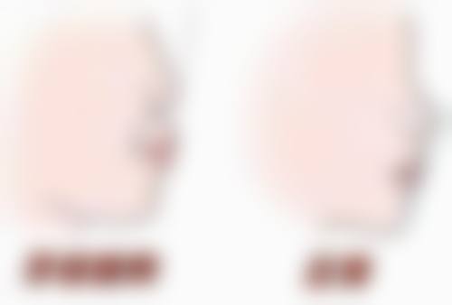 上海宏康医院口腔科：智齿位置复杂时贸然拔牙智齿怎么样？