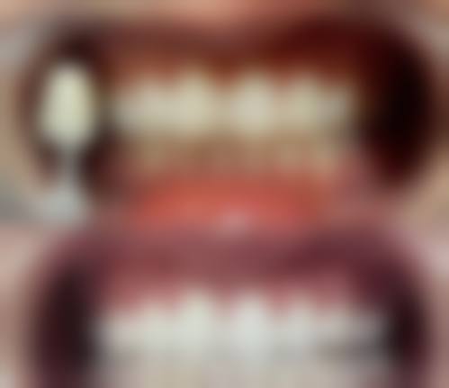 温州鹿城牙可美口腔门诊部价格表