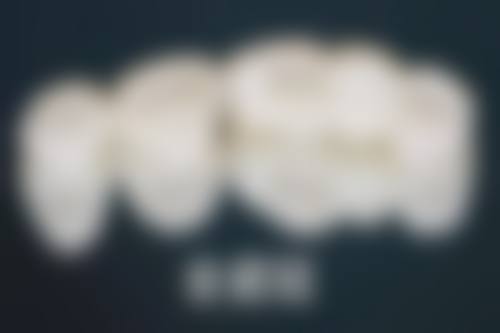 8岁矫正地包天的方法有哪些？