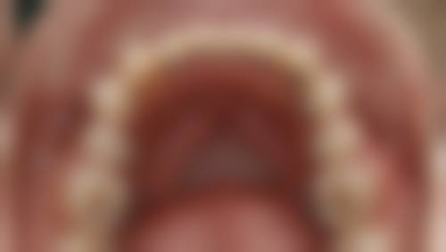 江门鹤山沙坪张雁旋牙科诊所执业信息：正规专精有保护