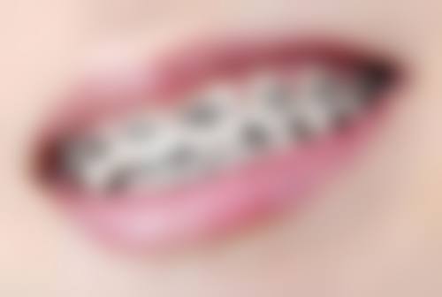 成年后在泉州海峡医疗美容门诊部做地包天矫正改变脸型怎么样？