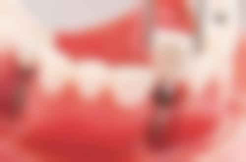 韩国erumi牙科医院价格表：合理收费透明消费