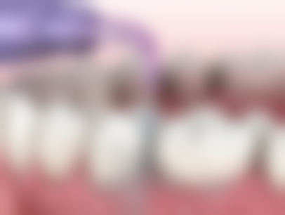 33岁做牙齿矫正成效怎么样？