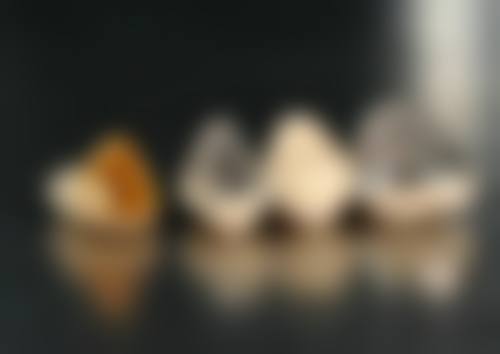 不同体质的人拔牙后吃冰淇淋适合吗