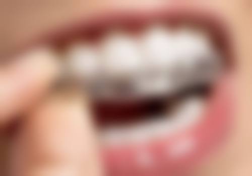 东莞宋存林口腔口碑怎么样：患者的真实评价