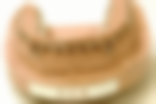 北京禾美嘉医疗美容评估骨骼烤瓷牙做核磁共振的依据靠谱吗？