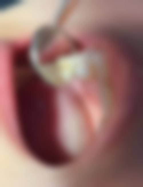 济南历下天真牙科口碑怎么样：患者好评，实力见证