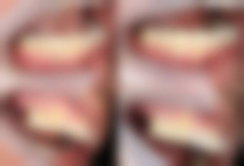 湘潭七颗牙口腔预约挂号方式:多种途径任你选