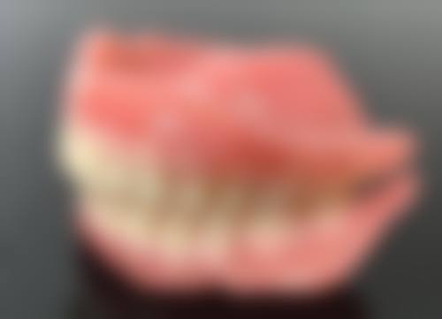 根管治疗后马上补牙靠谱吗？