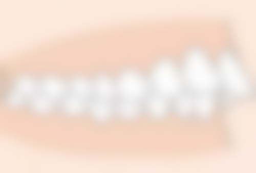 大连爱德丽格医疗美容洗牙后补牙间隔时间值不值？