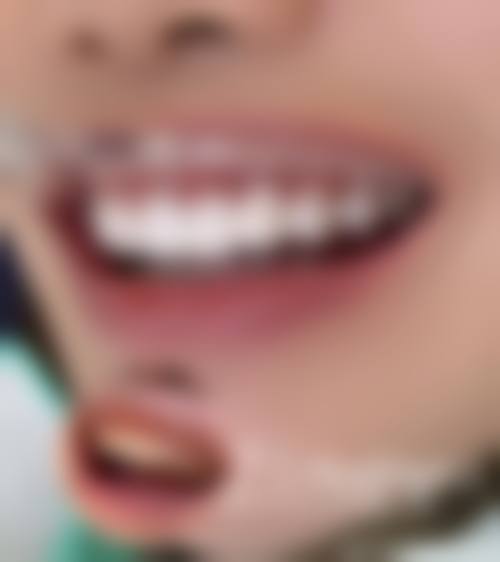 桂林源树口腔桂林北店真实实例