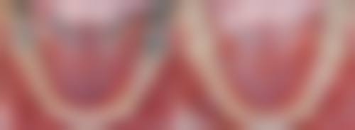 宁波周丽珍口腔电话号码：一键询问超方便