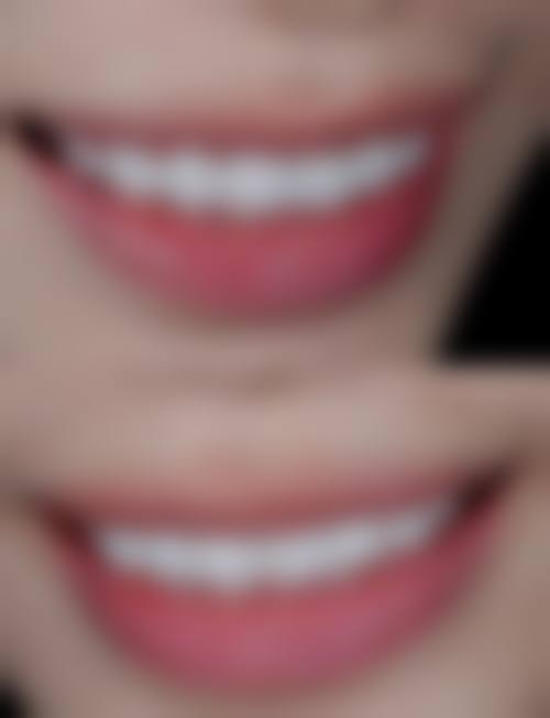 青海西宁熙阳阳口腔擅长项目：满足多样口腔需求