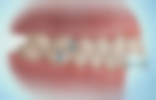 章建新医生技术特点：精细与创新并存