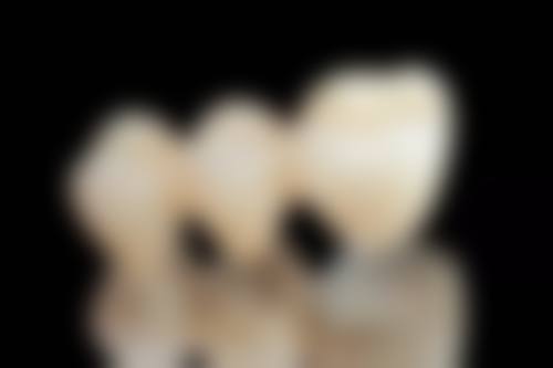 活髓保存治疗适合我吗？