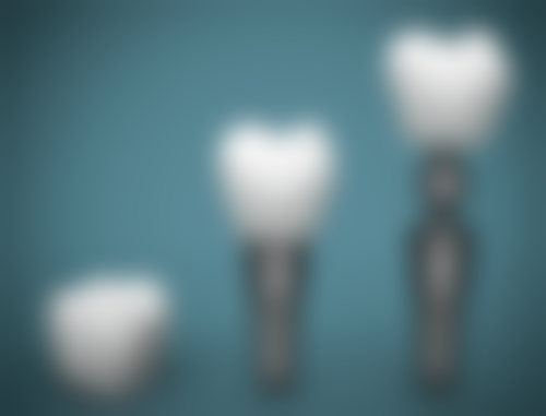 医生技术如何影响补牙后一般能维持多久？