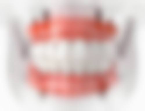 徐州紫浩口腔真实实例：见证治疗奇迹