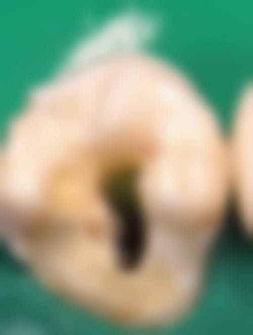 甘肃白银宗峰口腔诊所擅长项目：满足你的多样需求