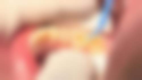 徐州紫浩口腔价格表：合理收费透明消费