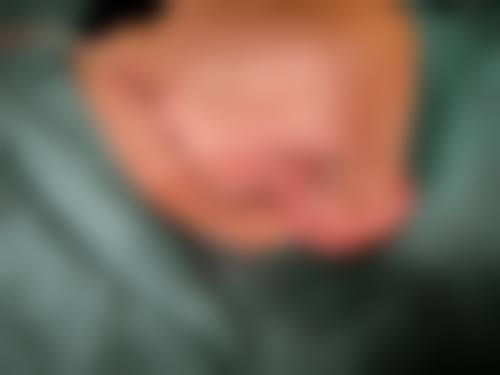 龙岩雅致口腔真实实例：见证治疗成效