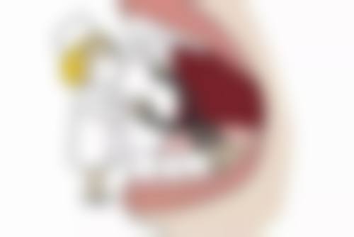 全瓷牙和贵金属烤瓷牙哪个对口腔更友好？辽宁省人民医院整形外科牙科具有影响力解读