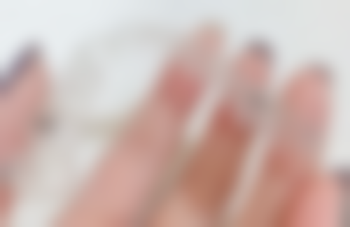 根管治疗后哪些情况不需要打桩？