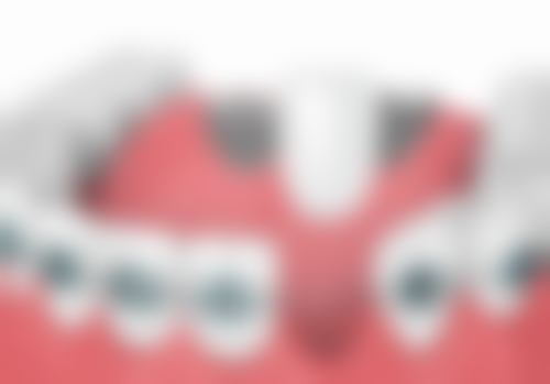 广州曙光医院口腔中 心补牙洞不杀神经值不值