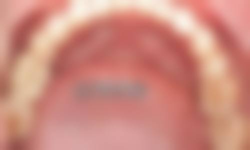 青海西宁市城东区赵岗绩口腔口碑怎么样：大家都说好