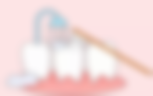 小诊所根管治疗的优势有哪些？