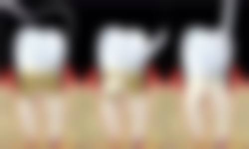 李福民医生技术特点:中西结合匠心独运