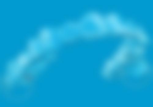 拔牙好几年了可以种植吗？口腔专家揭秘种植条件、流程及成功率，让你种牙不再迷茫！ 