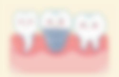 四川成都一牙桔子口腔连锁仪器设备