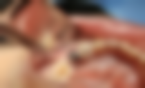 贵港蓝天口腔医院预约挂号方式