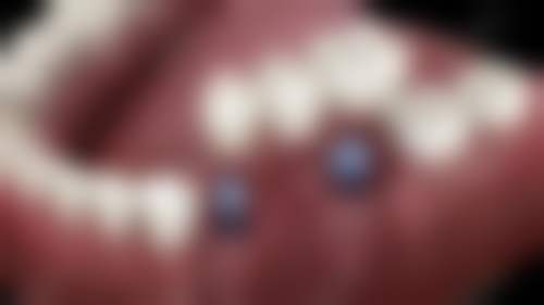 上海缔诗齿科·缔矢口腔门诊部擅长项目