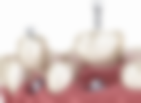 四川成都一牙桔子口腔连锁医生名单及实力