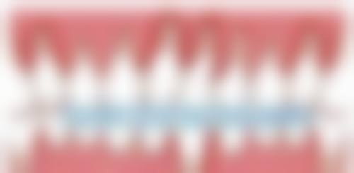 李福民医生的技术特点