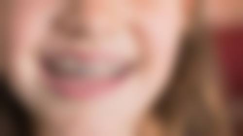 25根管治疗在沈阳美莱医疗美容医院成效好吗