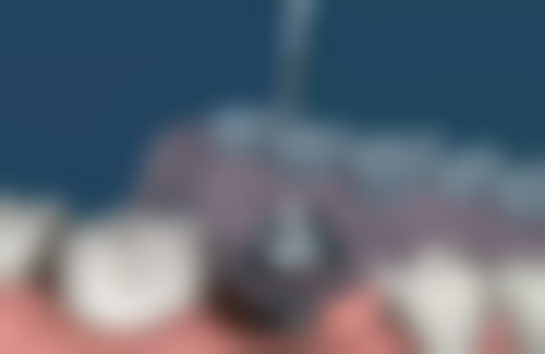 青岛黄岛区维湾泉云口腔门诊部价格表