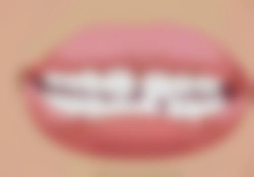 矫正牙齿 可以不拔牙吗？揭秘不拔牙矫正的 3 大关键因素，解答 90%患者的疑虑！ 