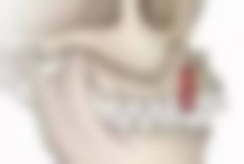 牙齿怎样种植牙的视频中展示的成效，真有那么好吗？