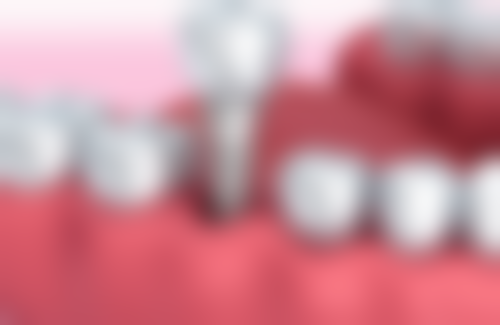 李师勇真实实例