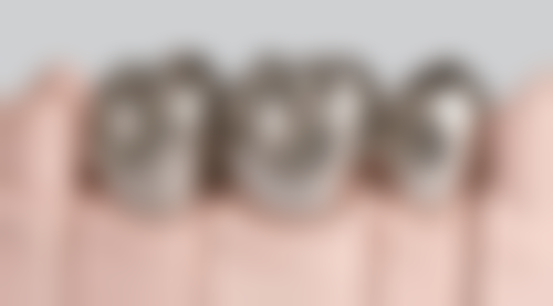 身患血疾病时拔牙风险大，在重庆韩佳牙博士口腔医院拔牙怎么样？