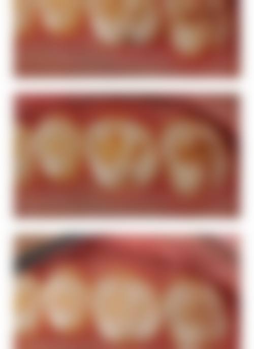 广东肇庆封开雅乐口腔预约挂号方式